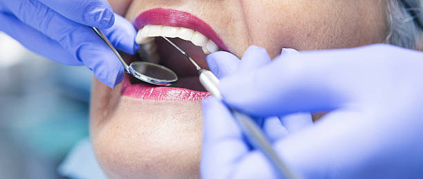 Best Weekend Emergency Dentist in Maplewood, WA